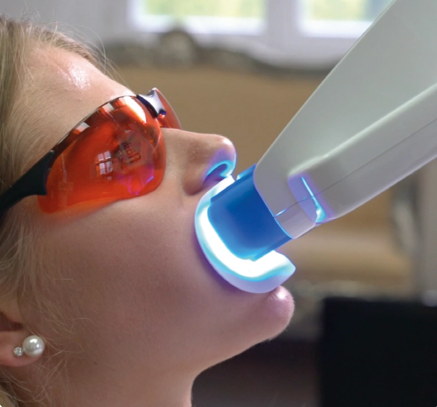 Professional tooth whitening with protective eyewear and the Fläsh light system